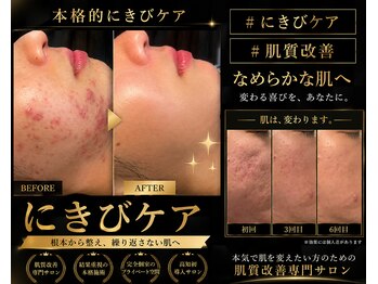 ミライ(Mirai)/凸凹肌◎オーダーメイドハーブ