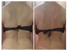 美容整体カラダリメイク(karada)/骨盤矯正ダイエットの結果