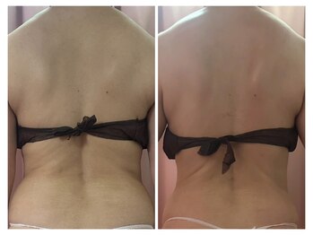 美容整体カラダリメイク(karada)/骨盤矯正ダイエットの結果