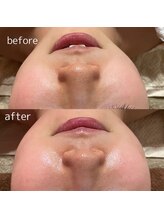 クーラ テュセ(Coeur la Tusais)/気になる毛穴の詰まりや黒ずみに