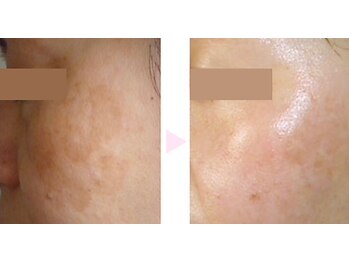 ノンノン(NonNon)/若々しい見た目へ