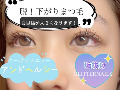 グリッターネイル(GLITTER NAILS)の写真