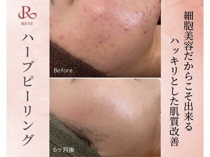 ククル(KUKULU)の写真