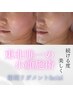 【新規】よくばりオーダーメイドコース[顔・背面]120分 ¥20000→¥15000