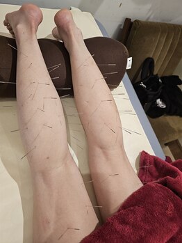 はりきゅう和 ルート鍼灸院/あしのだるさ