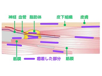 丸の内接骨院グループ 銀座リリース整体院/痛みや様々トラブルを起こす癒着