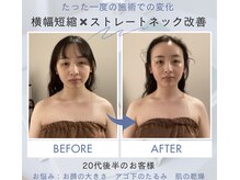 グレースフィオーレ 吉祥寺店(gracefiore)/横幅短縮＋ストレートネック改善