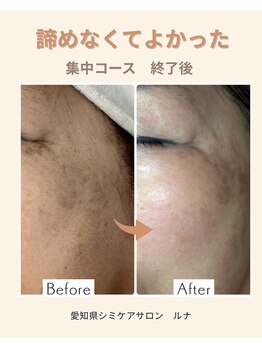 サロンルナ(Salon Luna)/70代女性７回目