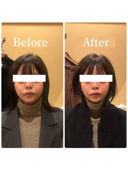 アキュレ(Acure)/