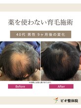 コレア整体院(COREA整体院)/ 再生育毛促進術