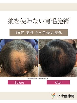 コレア整体院(COREA整体院)/ 再生育毛促進術