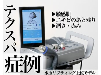 サロンヴェアリー 広尾(salon vary)/恵比寿広尾｜敏感肌水玉テクスパ