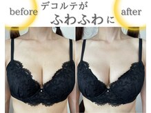 ラジュワード(lajward)の雰囲気（D→Eサイズアップ後もケアを続けて、さらにもっちりバストへ）