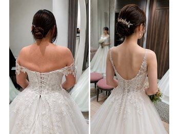 ビルーチェ(美LUCE)の写真/【人気No2】-11.5kg達成★『どこのエステ?』聞かれる花嫁続出★見た目悩みを骨格から!華奢見え姿勢美人へ