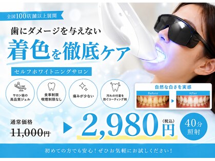 ホワイトニングショップ 宇都宮店の写真