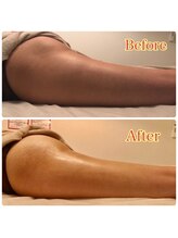 スターエステ(STAR ESTHE)/【ビフォーアフター】