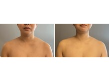 九月屋/小顔・肩首凝り