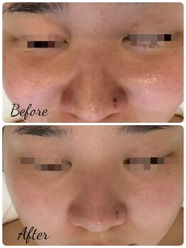 サロン ド ハニー(Salon de Honey)/ララピール