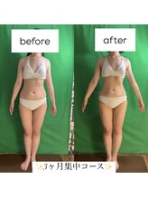 サンパティック 千葉店/☆3ヶ月集中ダイエット☆