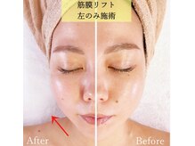 ソウ 新宿(SOU)の雰囲気（最新機器や技術を常に取り揃えてるのが人気の理由☆）