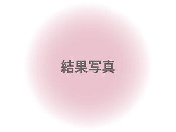 ファニービー 茨木店/Before→After
