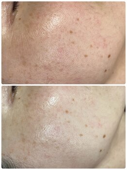 リノ(Lino)/プラズマニア1回の変化♪