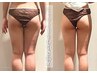【美脚★美尻痩せ】下半身痩せ/セル脂肪撃退 2回体験12,800円(1回/6,400円)