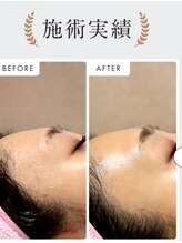 メディカルエステ ユウ(Yuu)/