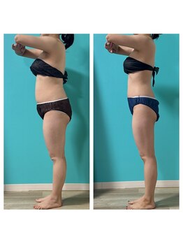 ネイト ワックス(Neit Wax)の写真/【ダイエットを成功へ導く◎】痩身とリンパマッサージの温感エステ♪/痩身/マッサージ/ブライダル