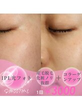 スムース イー(Smooth+E)/【顔脱毛】女性IPL光フォト