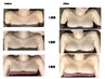 【モニター様限定】ボンボンバスト 通常1回22,000→12,000円×３回