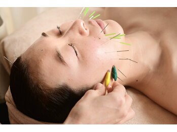 ルポ 那覇(repos)の写真/電気美容鍼★症状特化のコースでニキビ・むくみ・小顔・たるみなど肌コンディション底上げする本格ケア★