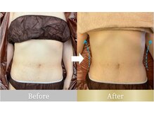 ウノジェンネ UNO DJENNE/60代★憧れのくびれ♪EMSキャビ!