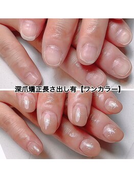 スマイルニコ(smile nico)/深爪が即日美爪に