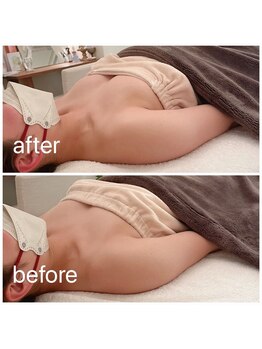 クラルス(clarus)/1度で結果が出るふわふわバスト