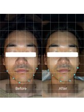 セメ(S’aimer)/脳洗浄で歪み改善