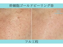 リメイククリニカルビューティー(Remake clinical beauty)/開き悩み解消