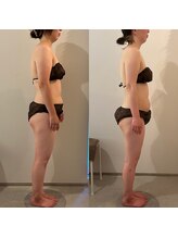 ラナ 京都西院店(Lana)/浮腫み・生理不調改善