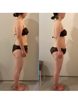 ラナ 京都西院店(Lana)/浮腫み・生理不調改善