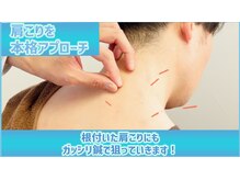 リケア道玄坂鍼灸院 渋谷(reCare)/肩こりを本格アプローチ