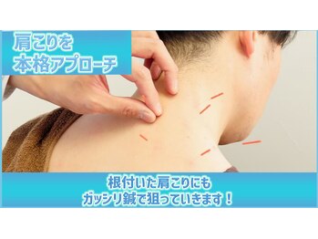 リケア道玄坂鍼灸院 渋谷(reCare)/肩こりを本格アプローチ