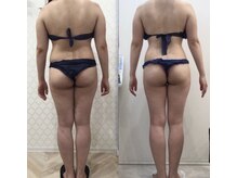 ルシアル 新宿代々木店(LUCIAL)/痩身オーダーメイド