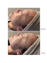 フイユ(feuille)/集中フェイシャルモニター様