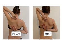アーユス(AYUS)/リンパマッサージ・BeforeAfter
