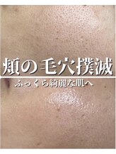 ミーラブ 鹿児島(miilove)