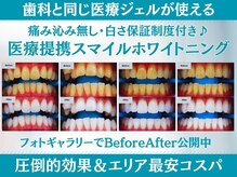 スマイルホワイトニング 練馬店