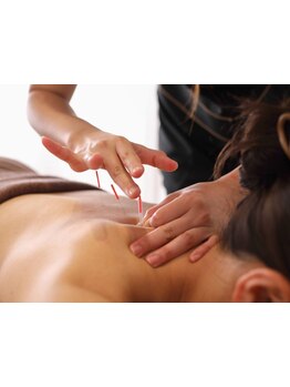 鍼灸施術を受けたい