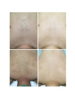 メンズサロンエヌエー(MEN'S SALON NA)/【敏感肌のお客様】