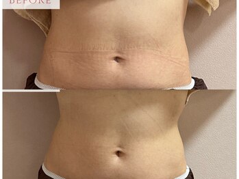 エミュ(emu)/ウエスト きゅ!!