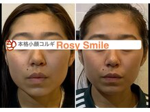 ロージースマイル(Rosy smile)/【韓国】　本格小顔コルギ　